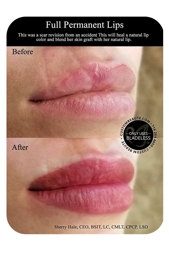 Permanent Lips in Amherst New York